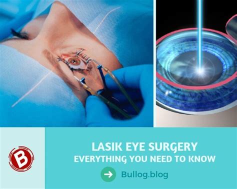 How LASIK Eye Surgery Works - Procedure, Risks, Cost and Recovery