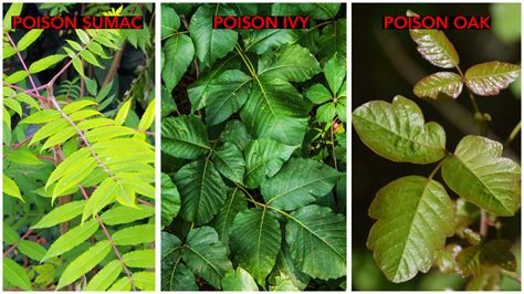 Poison Sumac Rash