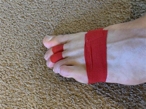 How To Tape Toes for Plantar Plate Tear - Plantar Health