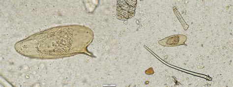 Identification of Schistosoma mansoni Infection in a Nonhuman Primate ...