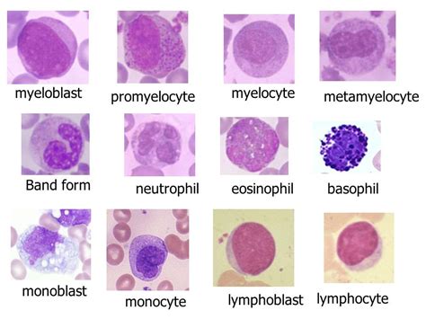 Pin de Yam Moors en Pathology | Hematología, Microbiología, Bioquímica