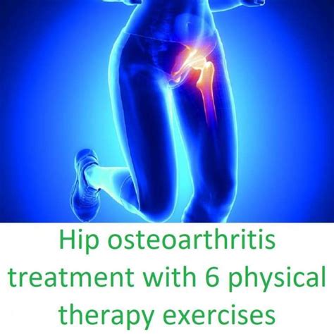 Hip osteoarthritis treatment with 6 physical therapy exercises