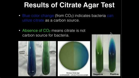 Citrate Test