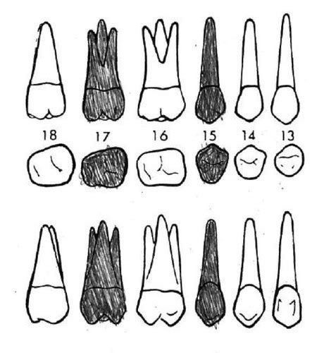 Odontogram symbols Flashcards | Quizlet