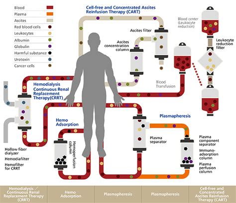 About Therapeutic Apheresis Therapy | Asahi Kasei Medical Co., Ltd.