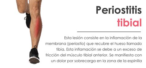 Periostitis tibial