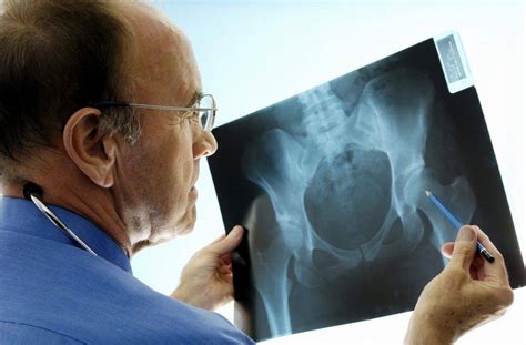 Orthopedic Surgeons | Georgia Bone & Joint Specialist Near Me