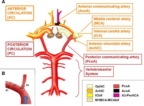 Risk of Rupture of Small Anterior Communicating Artery Aneurysms Is ...