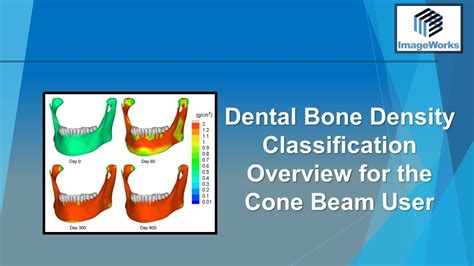 Dental Cone Beam Bone Density Overview - YouTube