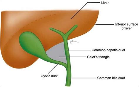 Image result for calot's triangle critical view of safety | Liver ...