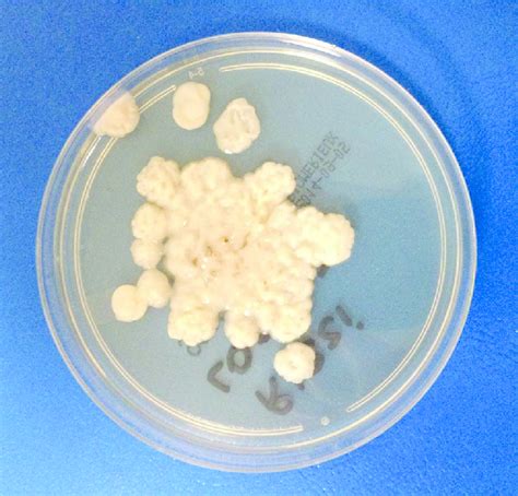 White creamy and smooth colonies of Trichosporon mucoides. | Download ...