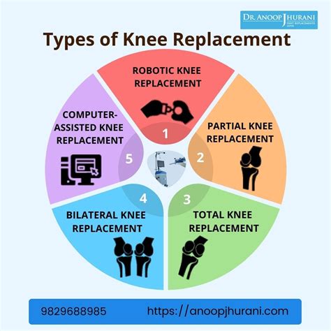 Types of Knee Replacement Surgery and Which One to Choose | by Dr ...