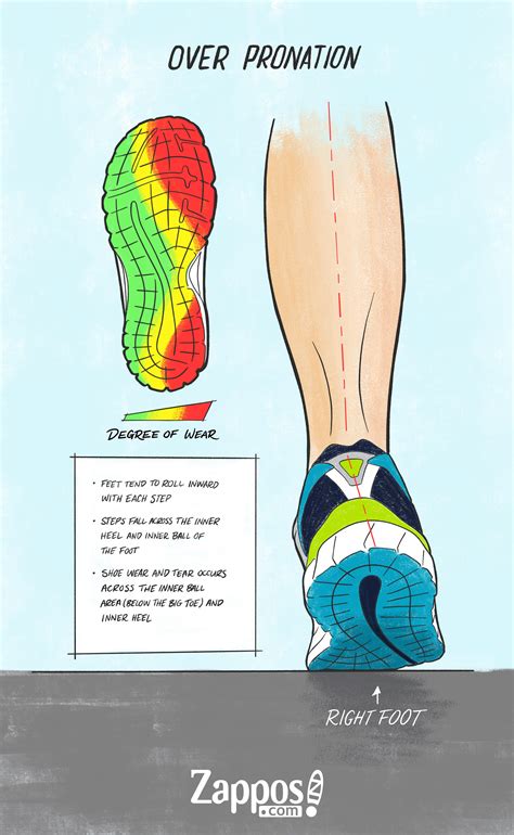 Type of Pronation | Zappos.com