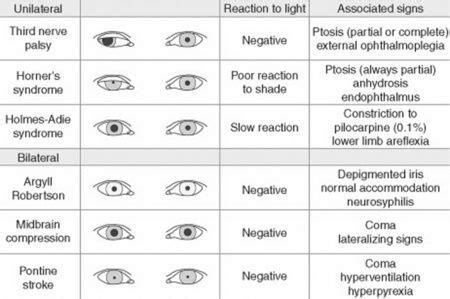 Pupil Size Chart Normal