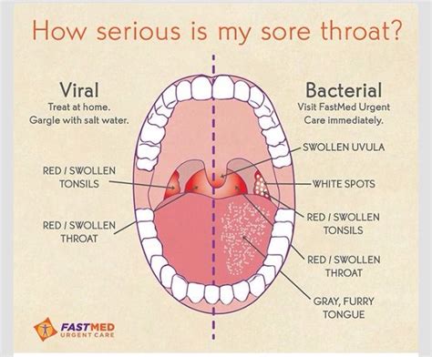 👍What Does Your Sore Throat Mean?👍 | Sick remedies, Health resources ...