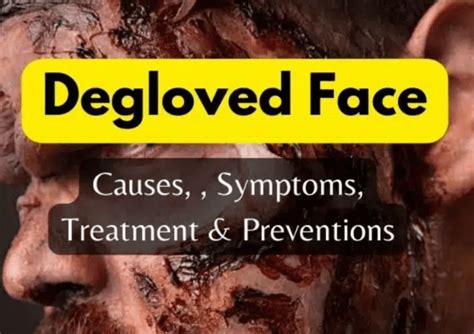 Degloved Face: Understanding the Causes, Impacts and Recovery