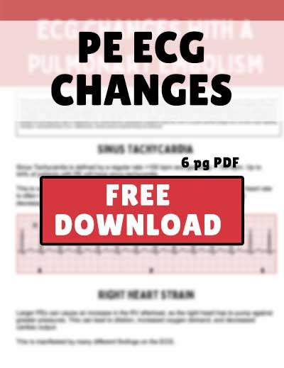 FREEBIE | PE ECG CHANGES | Health And Willness