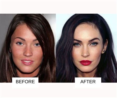 Celebrity Plastic Surgery: 31 Before And After Images | Fabbon