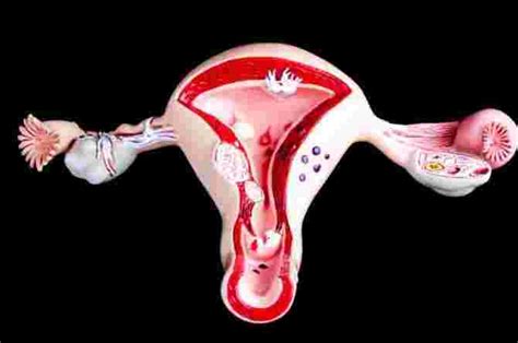 Septate Uterus Symptoms, Causes, Diagnosis And Treatment