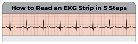 Ekg measuring strip – Telegraph