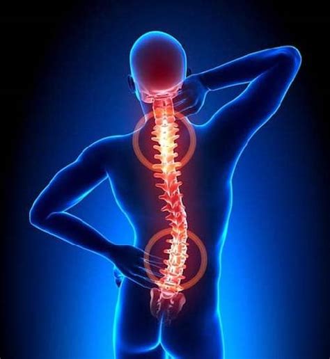 Back Pain: Causes, Symptoms, and Treatment