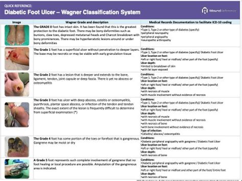 Diabetic Foot Ulcers - Classification Systems