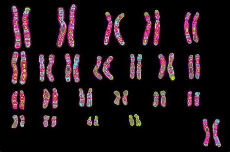 Karyotype | Description, Chromosome Aberration, & Uses | Britannica