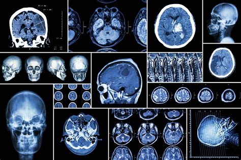 Which medical imaging technique? | KS3 design activity