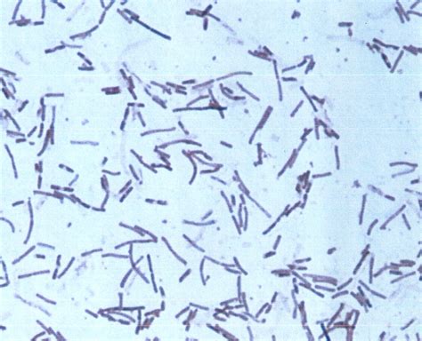 Sacrifices for the Love of Science: Bacillus subtilis