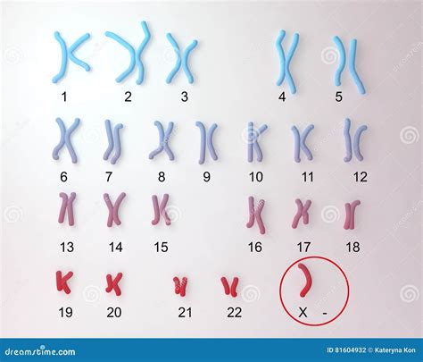 Turner S-syndrome Karyotype Stock Illustration - Illustration of ...