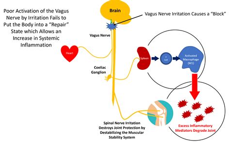 The Vagus Nerve, Inflammation, and the Neck: How are They Connected ...