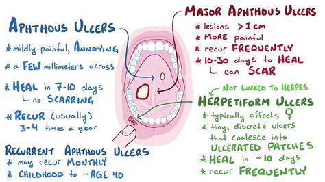 aphthous ulcer,what to do?