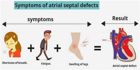 Atrial septal defect (Symptoms, Diagnosis, and Treatment) - Assignment ...