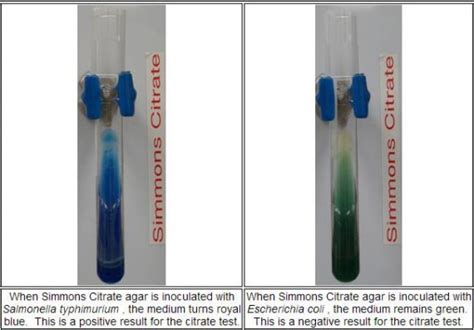 Simmons Citrate Agar | Medical Laboratories