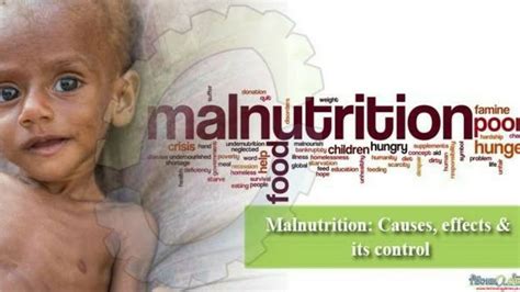 Malnutrition : Types and Classification , Symptoms And Treatment - YouTube