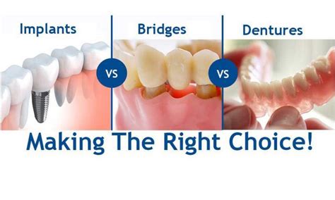 Flipper Tooth (Temporary Partial Denture) All You Need to Know