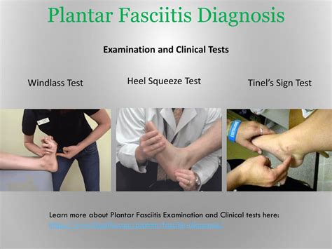 PPT - Plantar Fasciitis and Itâ€™s Treatment PowerPoint Presentation ...