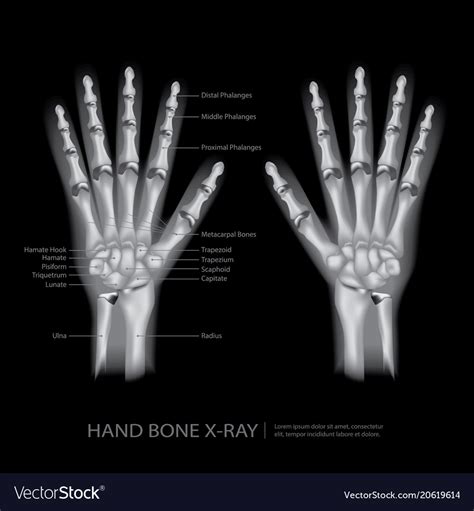 Hand bone x-ray Royalty Free Vector Image - VectorStock