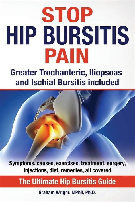 9 best exercises for hip bursitis video included – Artofit