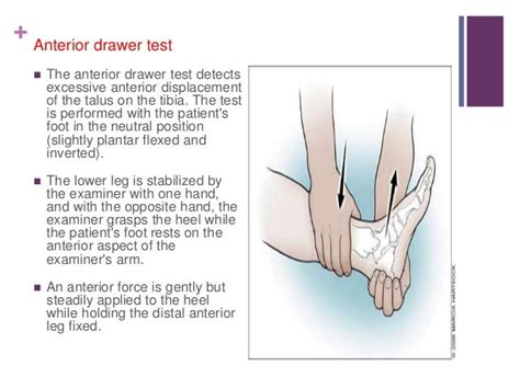 nursing bibs: Anterior drawer test