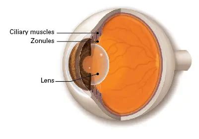 Zonules - American Academy of Ophthalmology