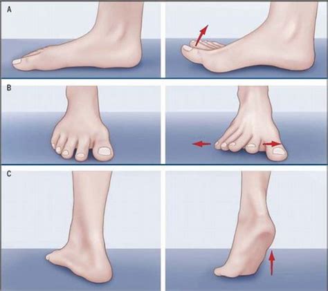 Home Remedies to Treat, Exercise, and Prevent Bunions | WalkJogRun