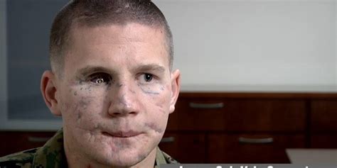 Marine Who Was Severely Injured Protecting Friend To Receive Highest ...