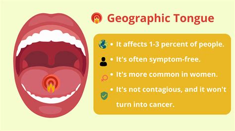 Geographic Tongue