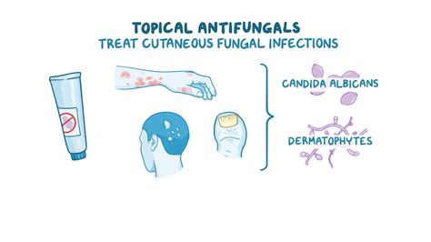 Antifungals - Topical: Nursing pharmacology - Osmosis Video Library