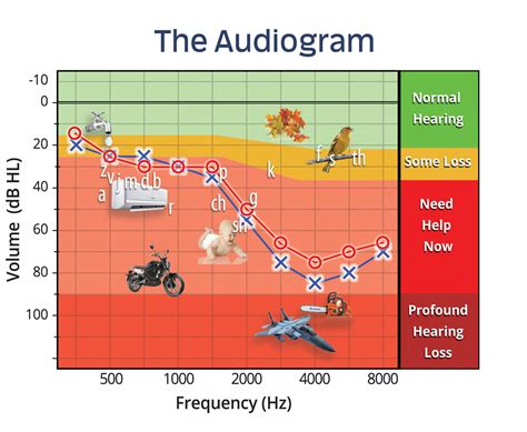 Understanding your Audiogram | Australian Audiology Services - Gold ...