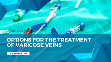 Options for the Treatment Of Varicose Veins - St Johns Vein Center