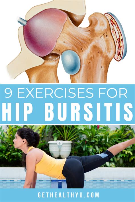 Exercises To Treat Hip Bursitis Bursitis Hip Bursitis Hip | The Best ...