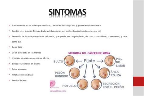 Cancer De Seno Sintomas Y Signos