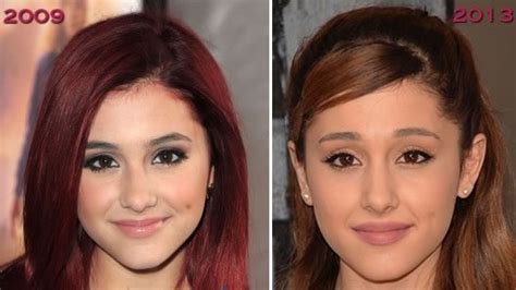 Ariana Grande Nose Job Plastic Surgery Before And After Pictures | 2018 ...